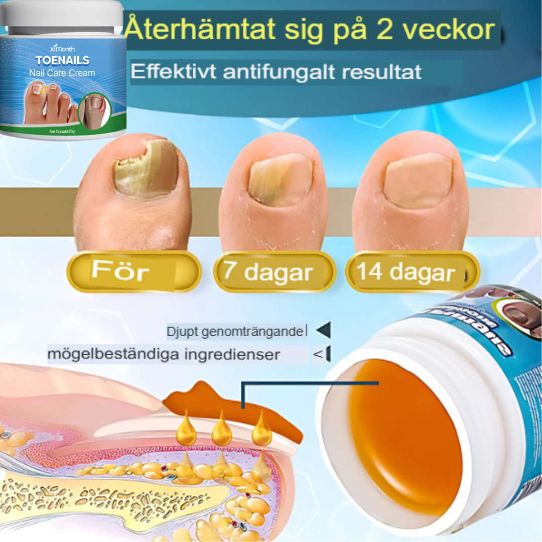 TotalCare Nagelsvampbehandling för Tånaglar | Effektiv Nagelåterställning & Vård