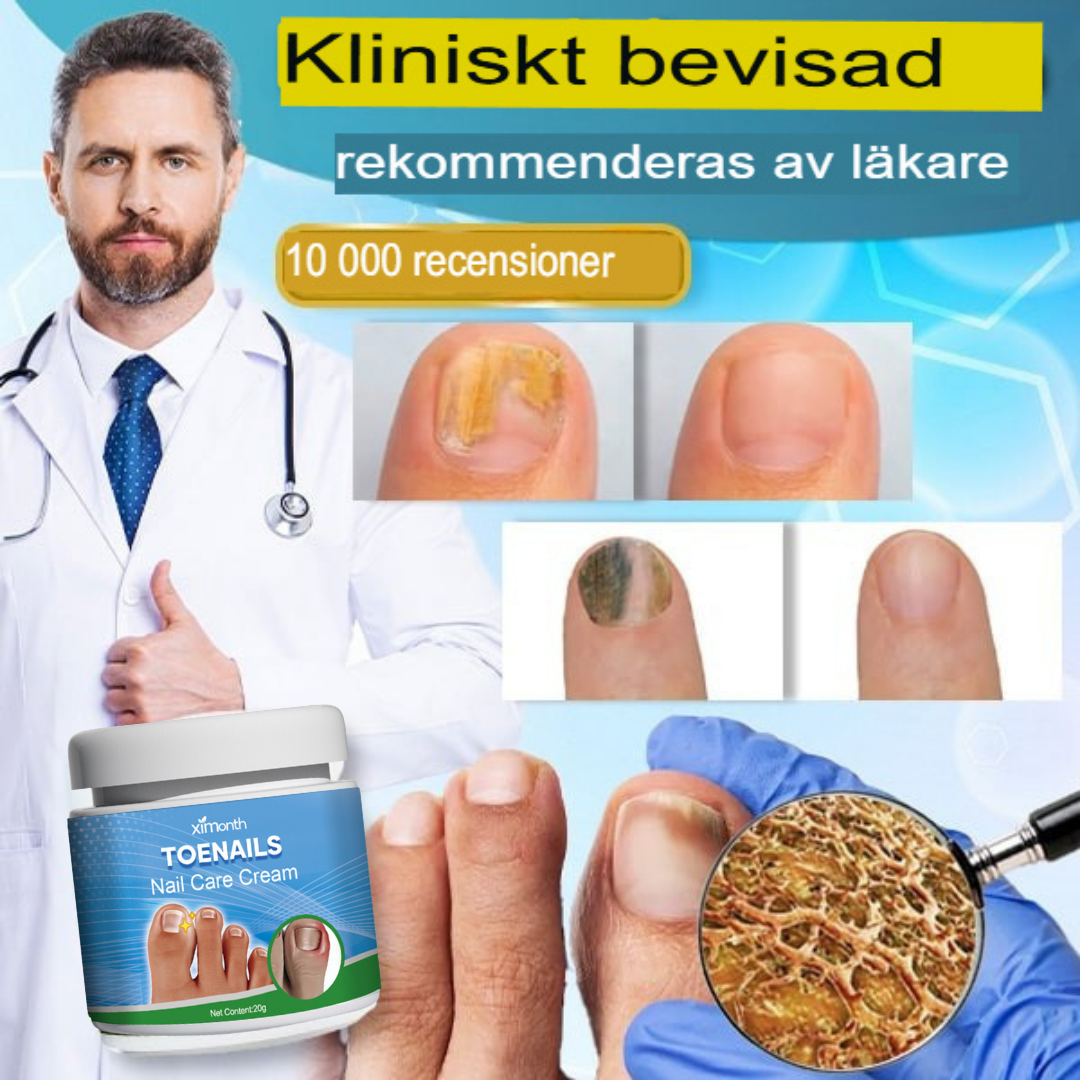 TotalCare Nagelsvampbehandling för Tånaglar | Effektiv Nagelåterställning & Vård
