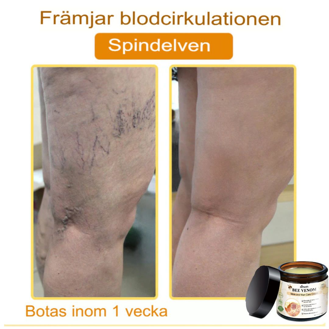 SkinClear | Bivene Behandlingskräm för Vårtor och Molar