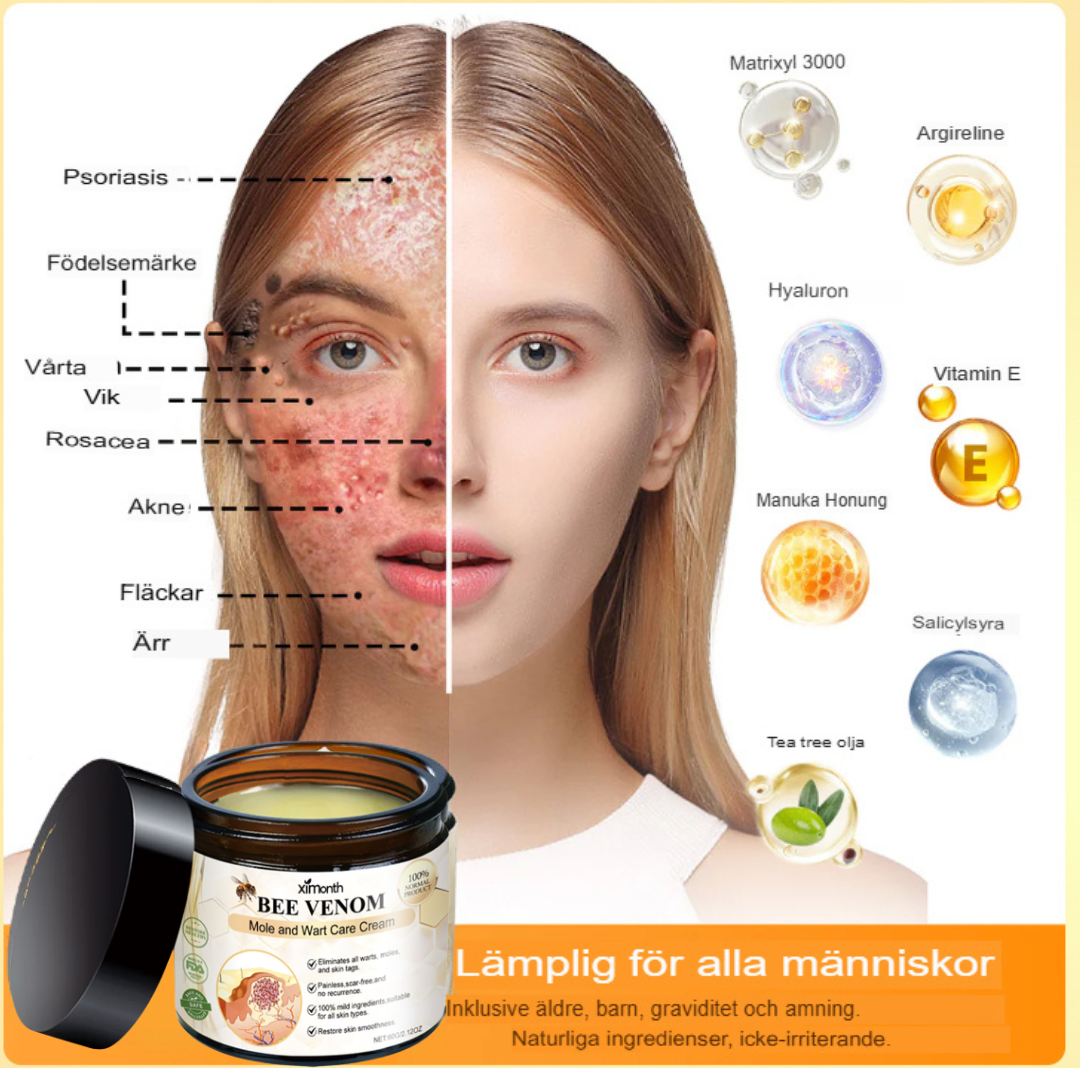 SkinClear | Bivene Behandlingskräm för Vårtor och Molar