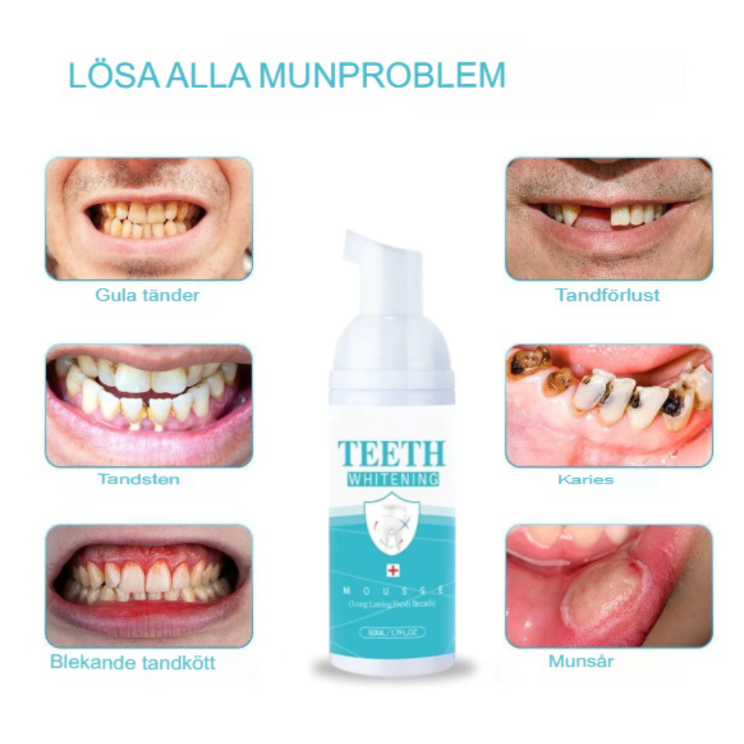 Omedelbar Tandblekningsskum | Snabbverkande Dental Förbättrare