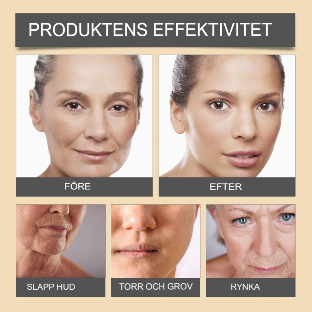 Botox | Slät, ungdomlig hud – Beställ nu! 🐝✨