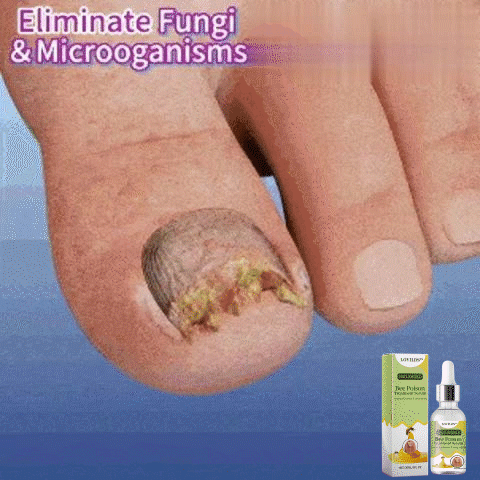 NailCare™ | Beende Nagelschäden für immer