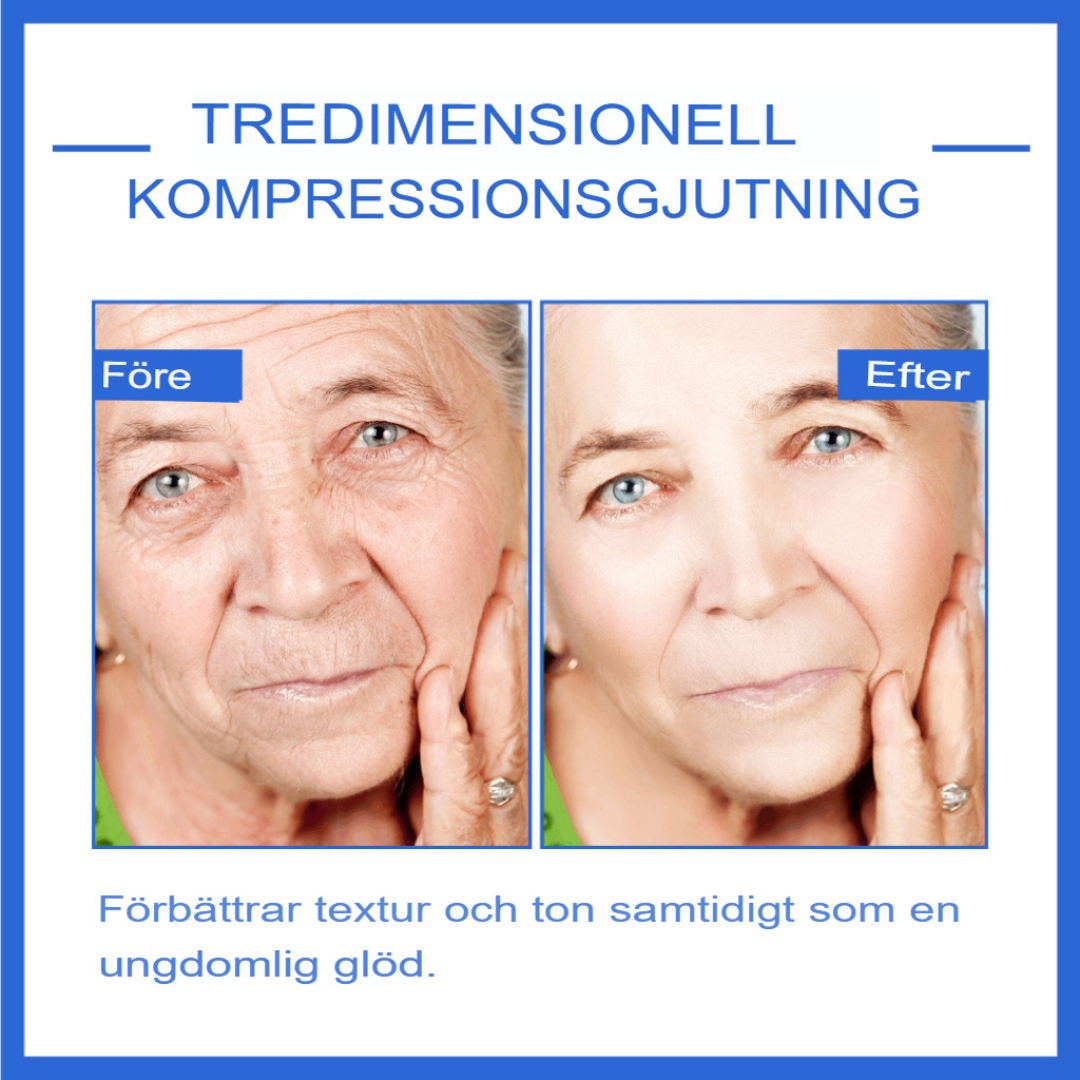 AgeDefy | Botox Stock-lösning för Avancerad Rynkreduktion