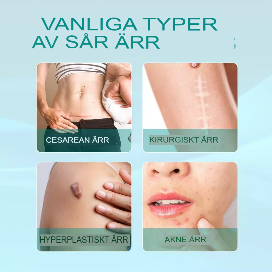 Avancerad Spray för Ärrborttagning | Snabb Läkning & Hudreparation