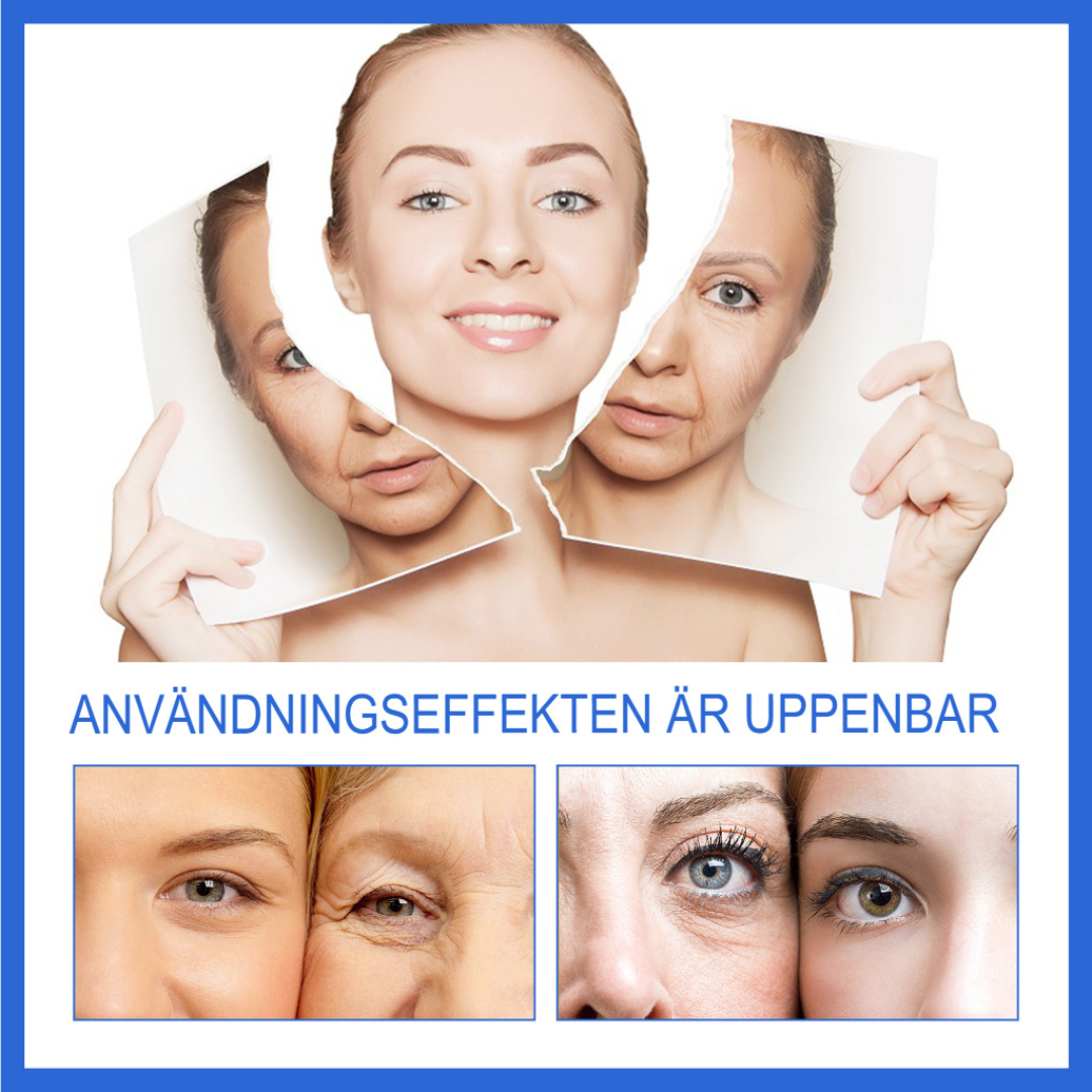 AgeDefy | Botox Stock-lösning för Avancerad Rynkreduktion