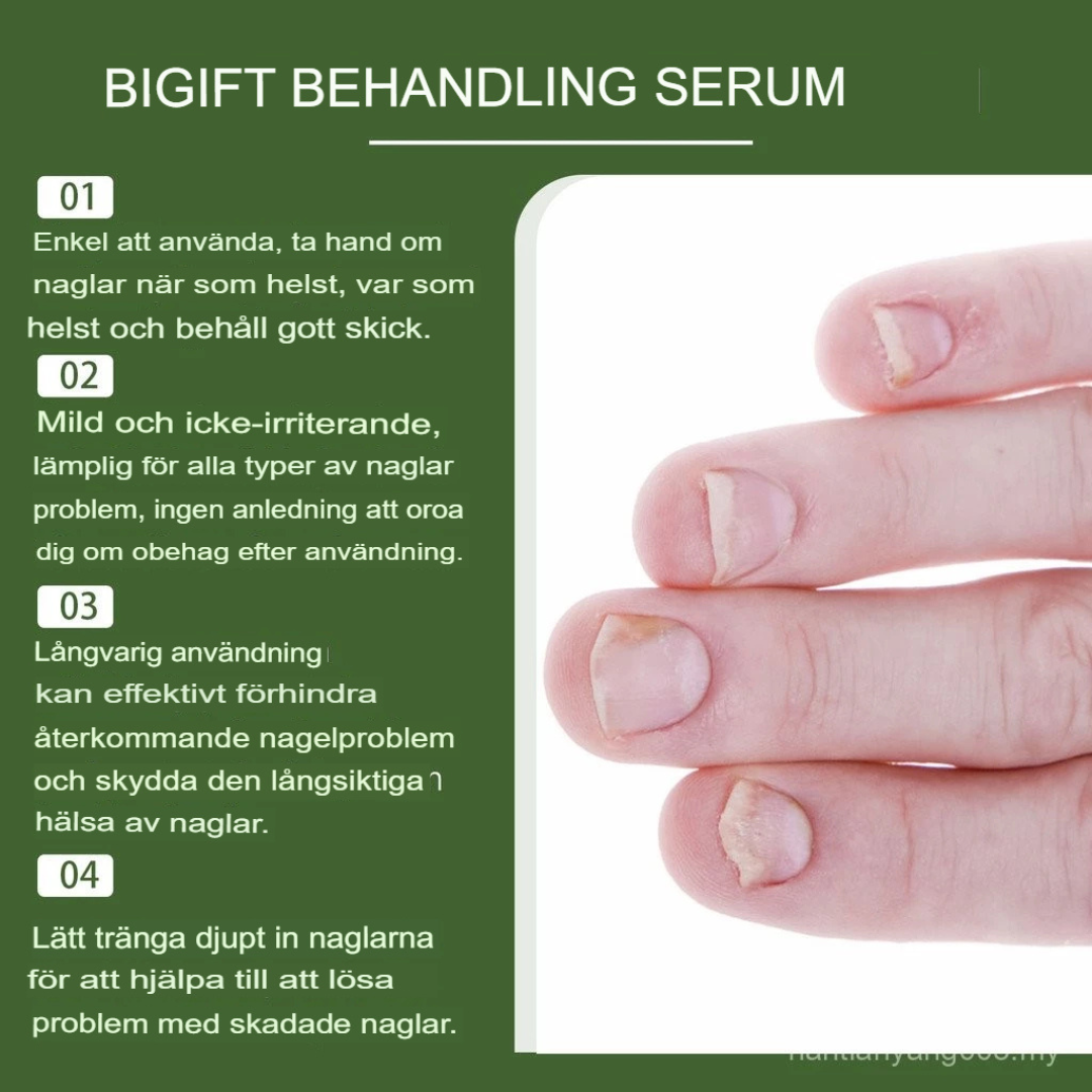 Bee Venom Behandlingsserum för Nagelsvamp | Snabbverkande, Långvarig Lättnad