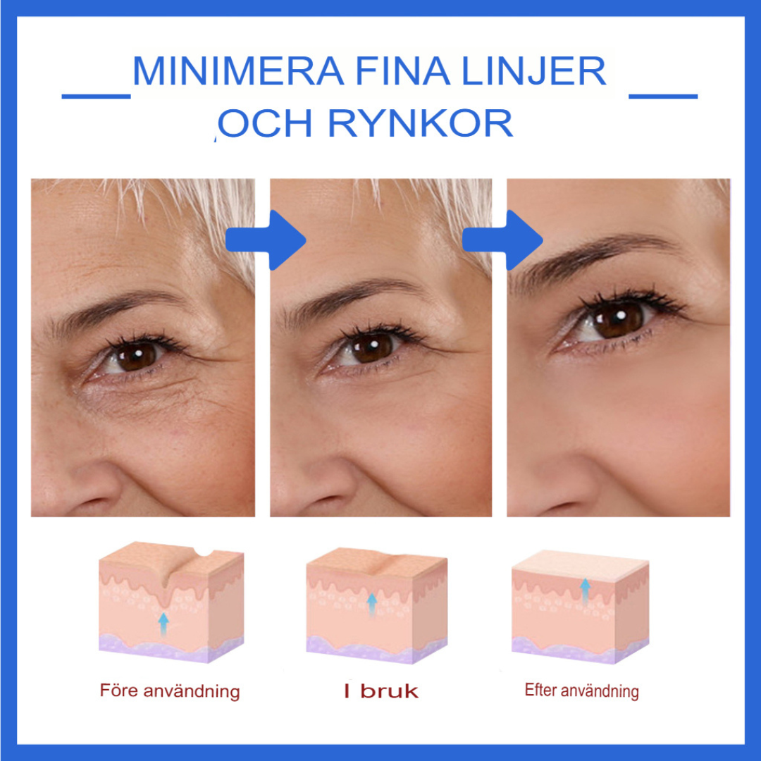 AgeDefy | Botox Stock-lösning för Avancerad Rynkreduktion