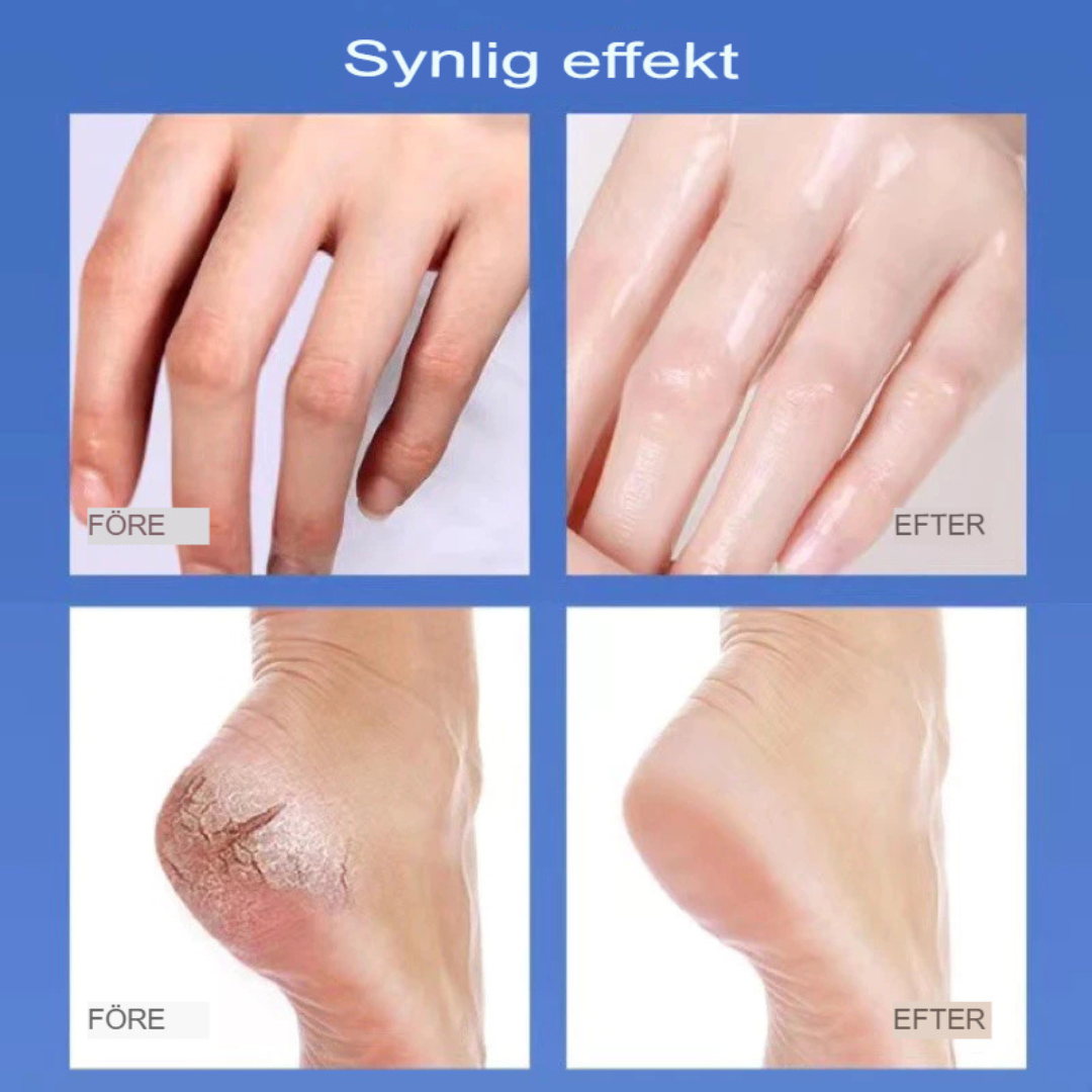 TotalRepair Antisprickkräm | Intensiv Återfuktande Behandling för Händer & Fötter