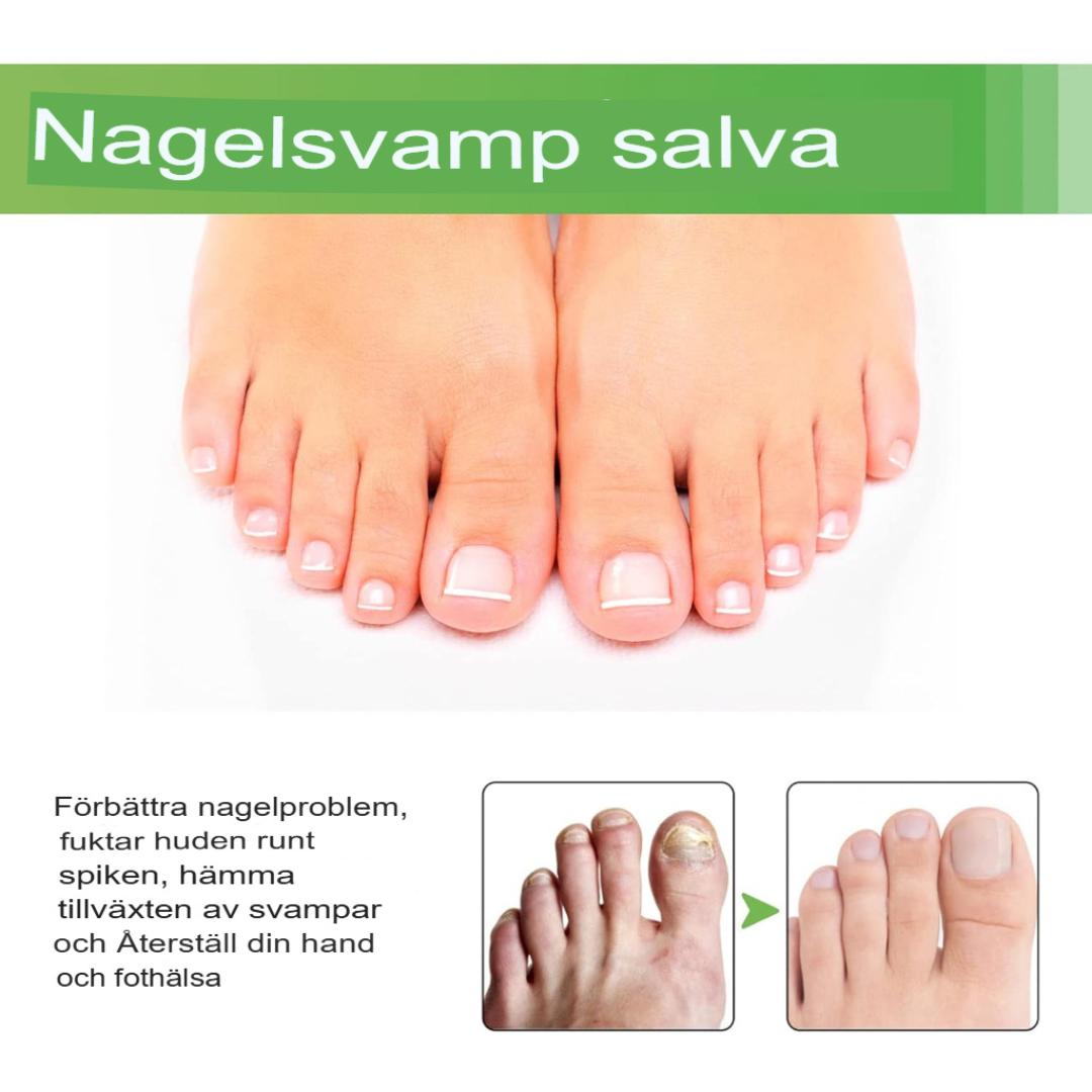 TotalCare Nagelsvampbehandling för Tånaglar | Effektiv Nagelåterställning & Vård
