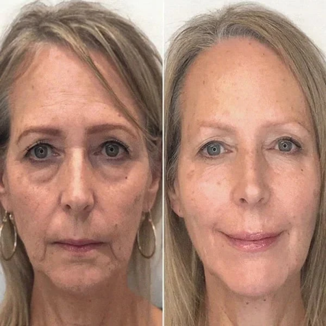 Botox Ansiktsserum | Avancerad Anti-Rynk Formel med Argireline & Kollagenpeptider