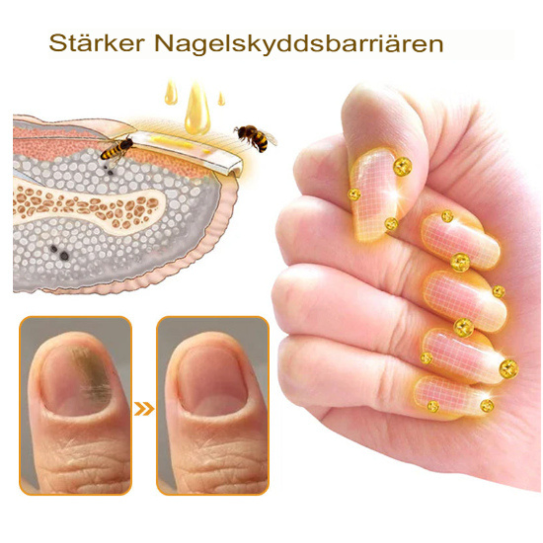 Bee Venom Behandlingsserum för Nagelsvamp | Snabbverkande, Långvarig Lättnad
