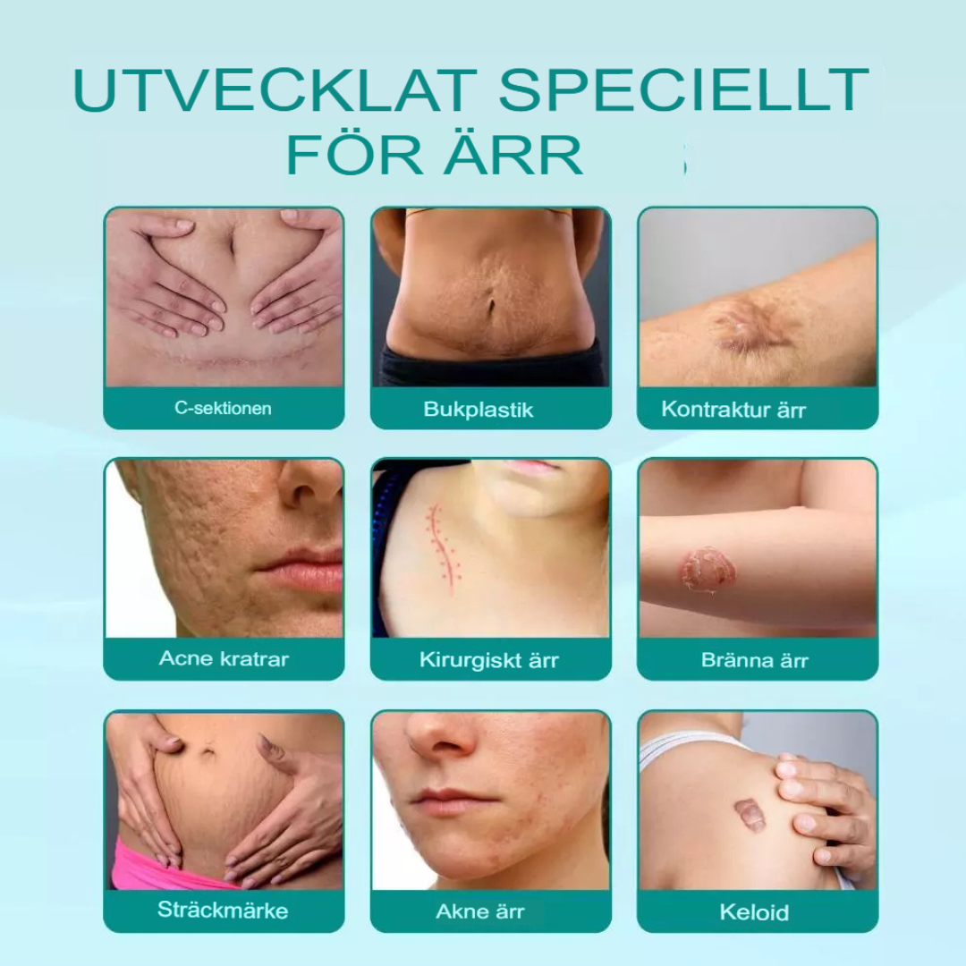 Avancerad Spray för Ärrborttagning | Snabb Läkning & Hudreparation