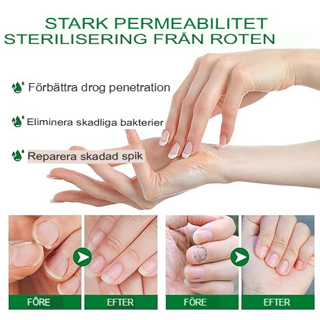 7 Dagars Ingefära Nagelsvampbehandling | Helt Naturligt Antisvamp-Serum för Hand- och Fotvård