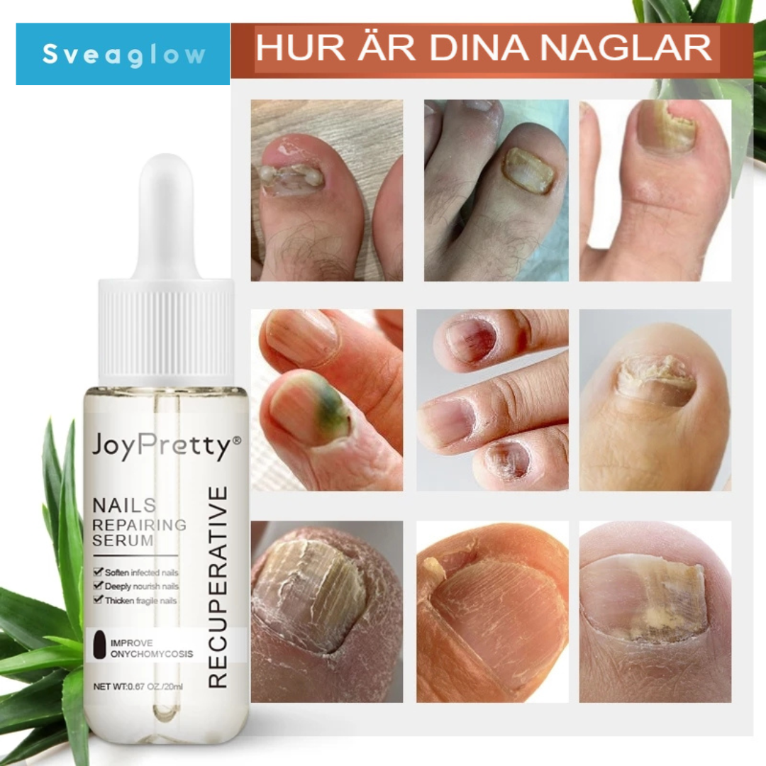 Nailcure | Omedelbar lösning mot nagelsvamp – Beställ nu! 💅🦠