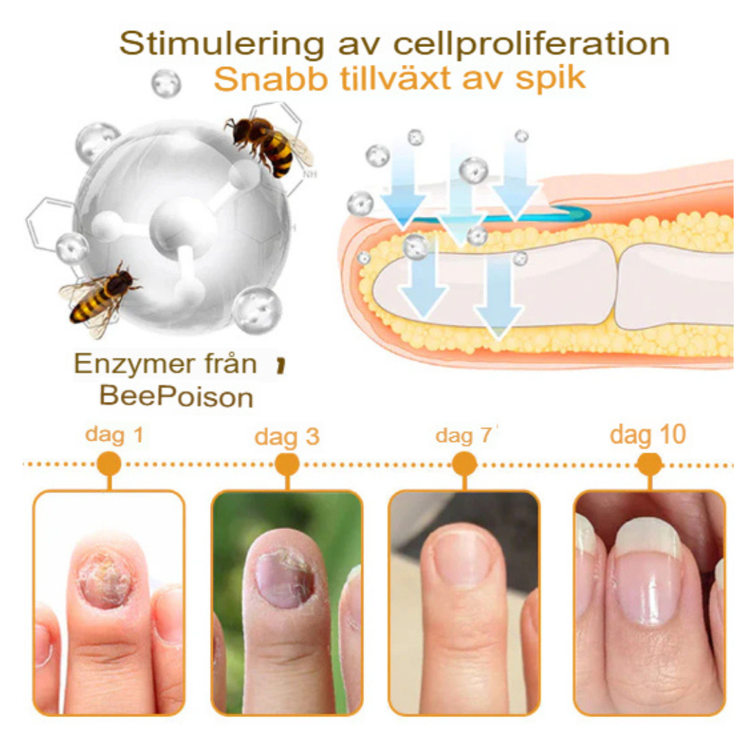 Bee Venom Behandlingsserum för Nagelsvamp | Snabbverkande, Långvarig Lättnad