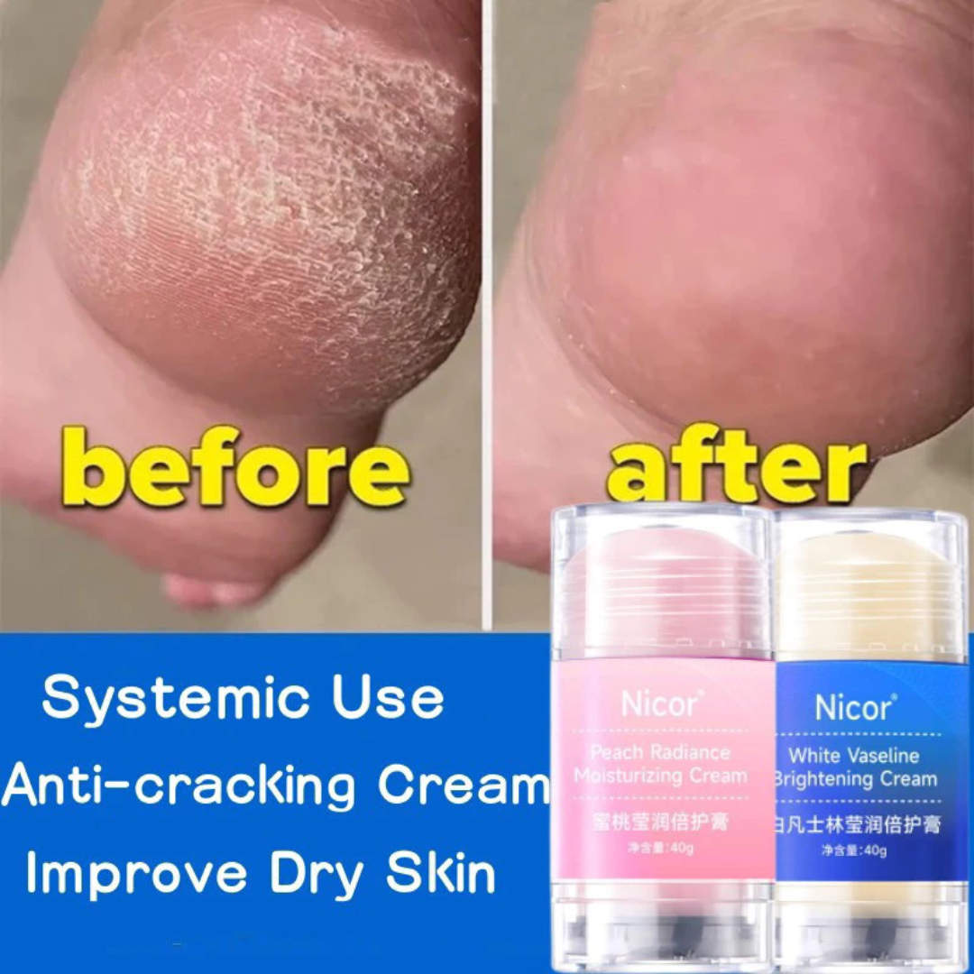TotalRepair Antisprickkräm | Intensiv Återfuktande Behandling för Händer & Fötter