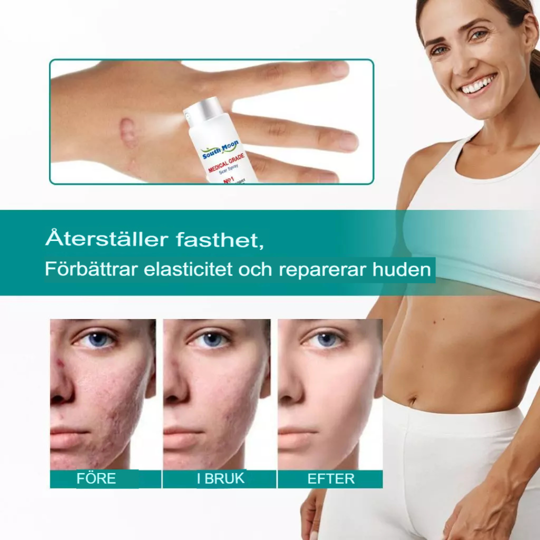 Avancerad Spray för Ärrborttagning | Snabb Läkning & Hudreparation