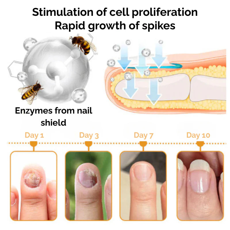 NailCare™ | Beende Nagelschäden für immer