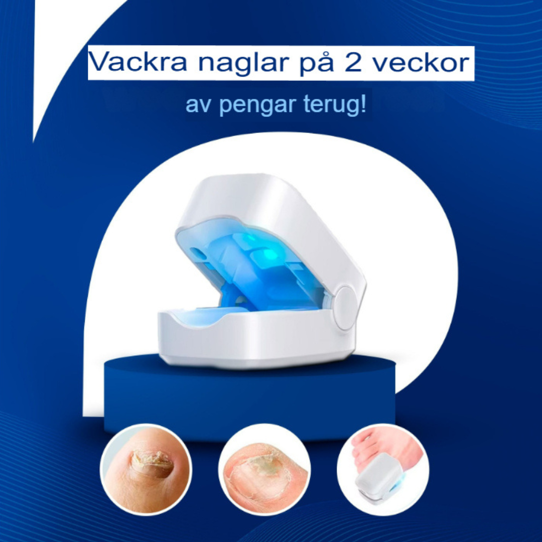 Avancerad Laserbehandling för Nagelsvamp | Snabb och Effektiv