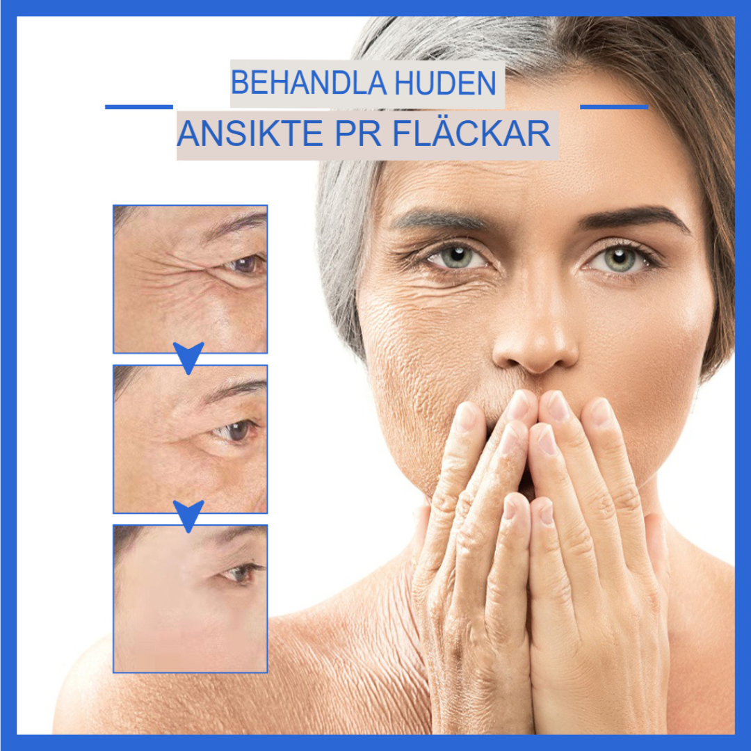 AgeDefy | Botox Stock-lösning för Avancerad Rynkreduktion