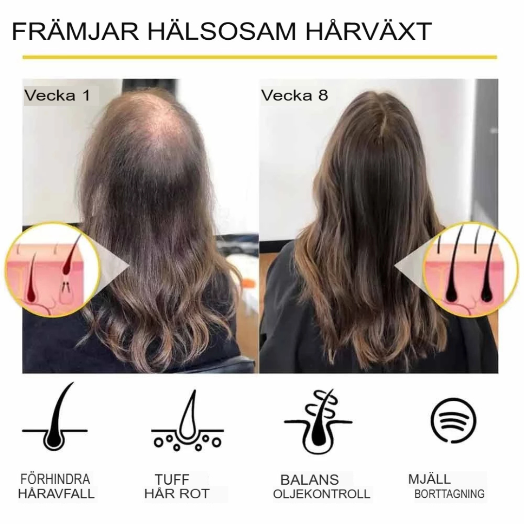 DenseFlow - Essentiell Hårväxtolja | Naturlig Lösning för Tätare Hår