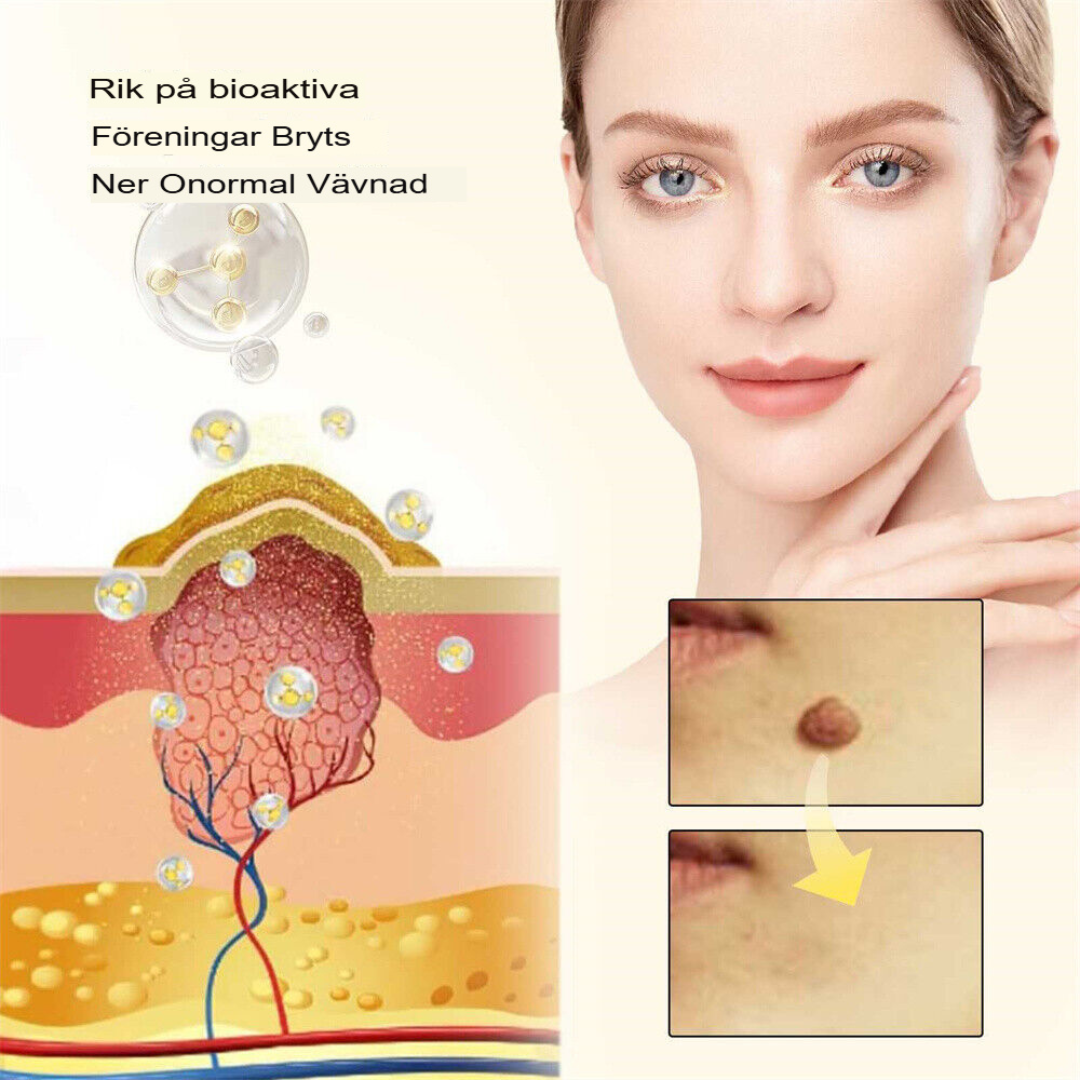 SkinClear | Bivene Behandlingskräm för Vårtor och Molar