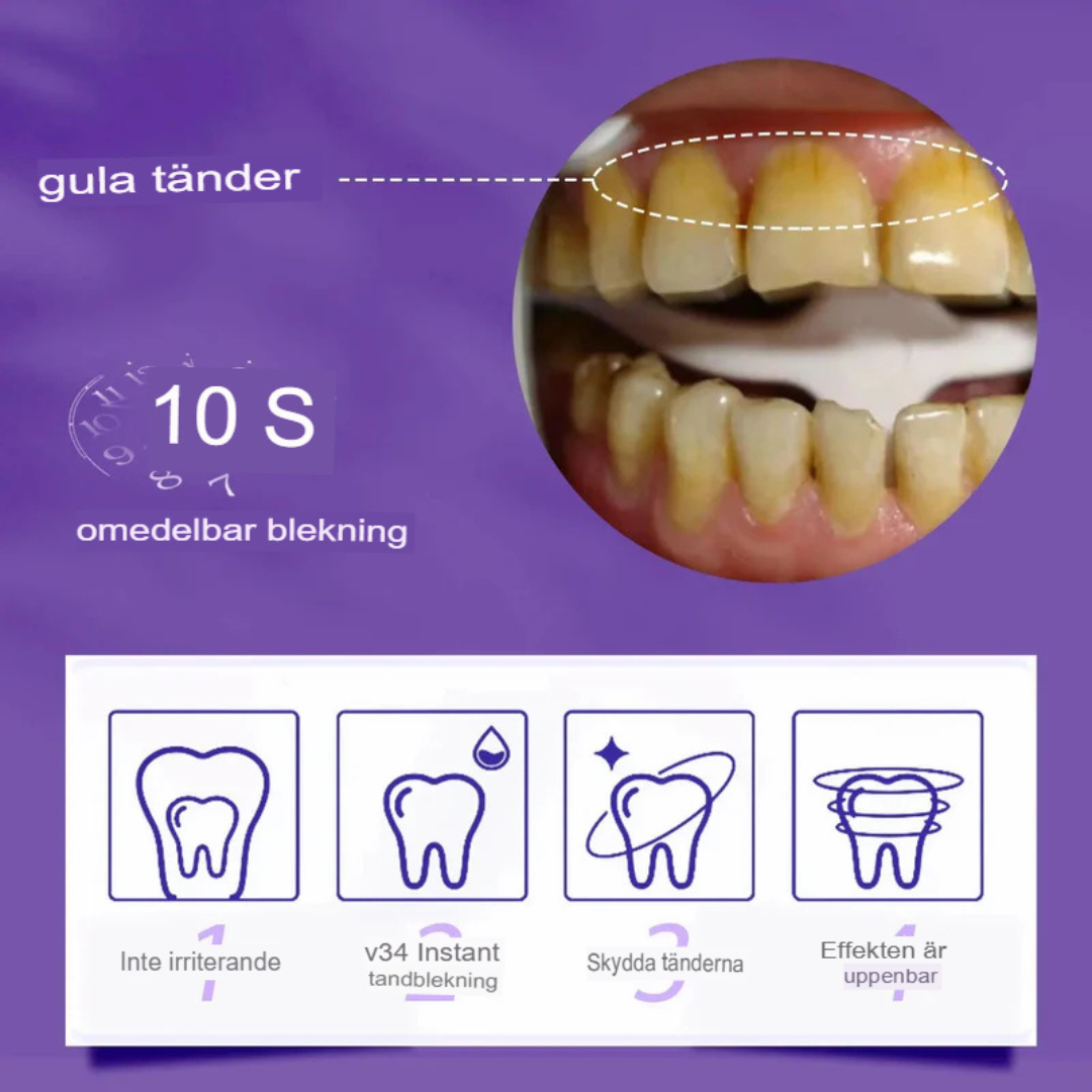 RadiantSmile | Avancerat V34 Tandblekningsserum