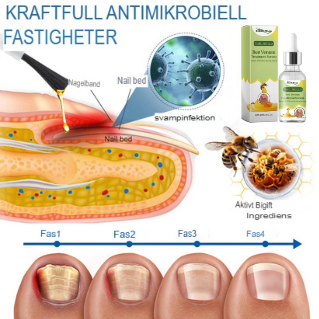 Bee Venom Behandlingsserum för Nagelsvamp | Snabbverkande, Långvarig Lättnad