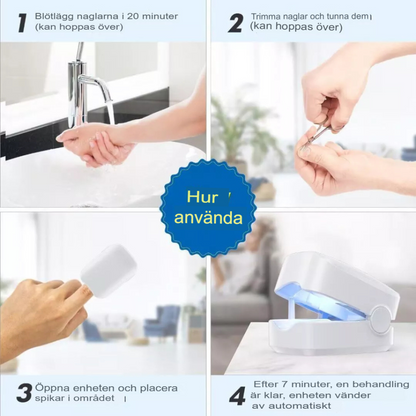 Avancerad Laserbehandling för Nagelsvamp | Snabb och Effektiv
