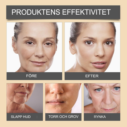 Botox | Slät, ungdomlig hud – Beställ nu! 🐝✨