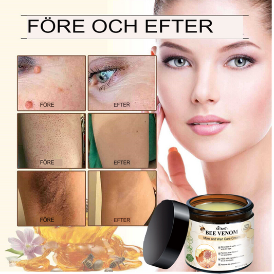 SkinClear | Bivene Behandlingskräm för Vårtor och Molar