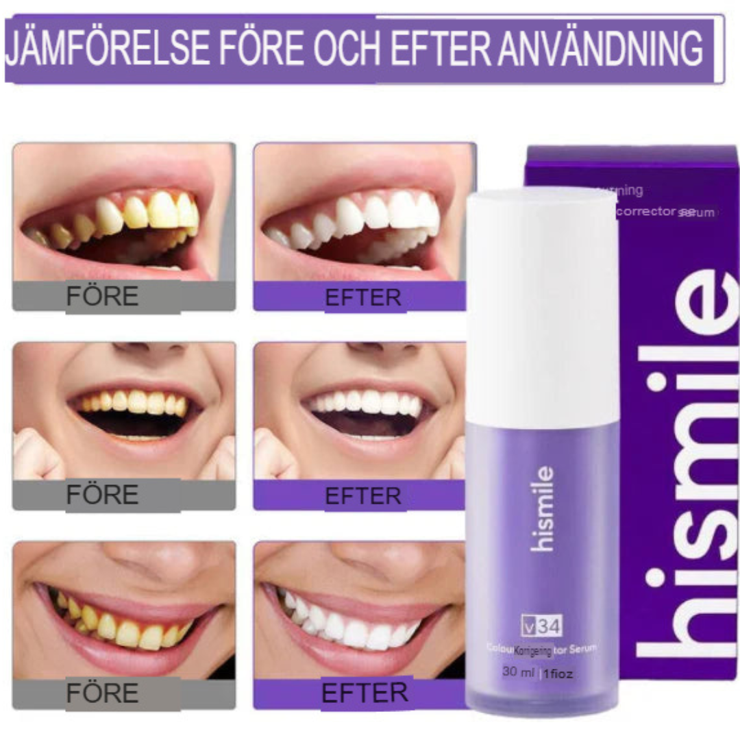 RadiantSmile | Avancerat V34 Tandblekningsserum