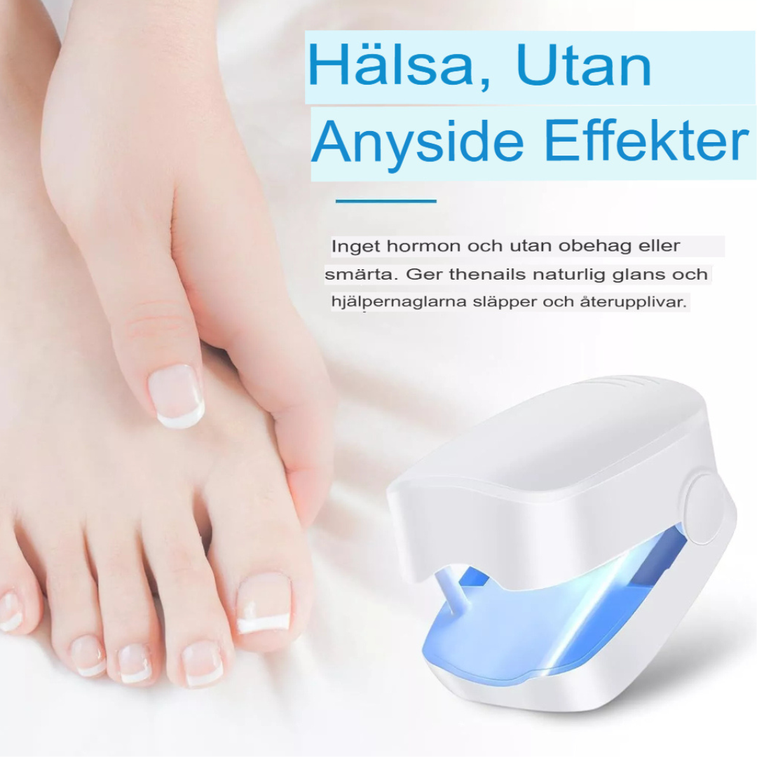 Avancerad Laserbehandling för Nagelsvamp | Snabb och Effektiv
