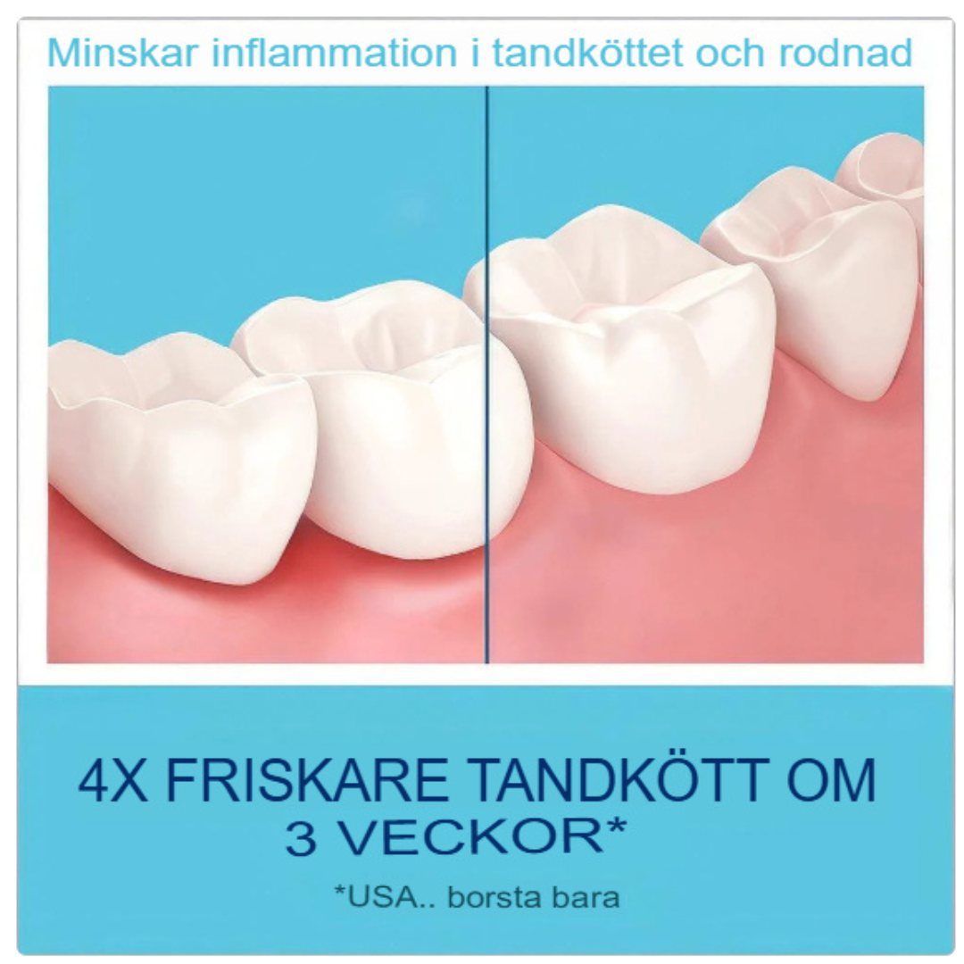 Omedelbar Tandblekningsskum | Snabbverkande Dental Förbättrare