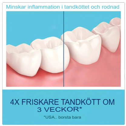 Omedelbar Tandblekningsskum | Snabbverkande Dental Förbättrare