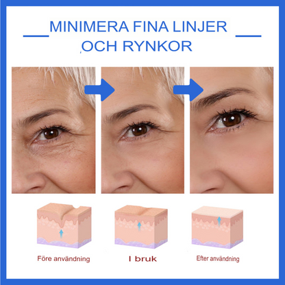 AgeDefy | Botox Stock-lösning för Avancerad Rynkreduktion