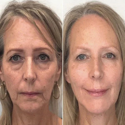 Botox Ansiktsserum | Avancerad Anti-Rynk Formel med Argireline & Kollagenpeptider