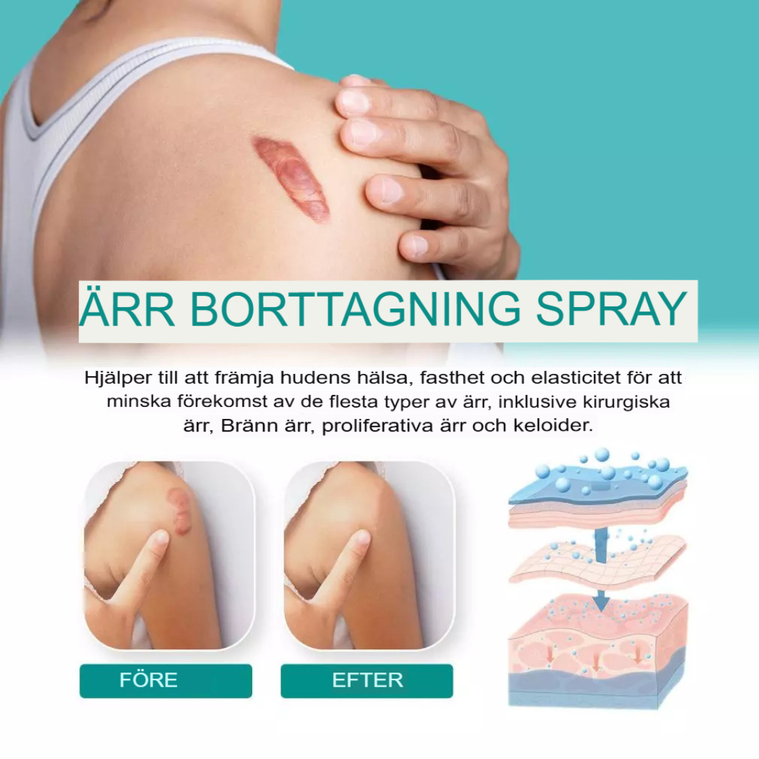 Avancerad Spray för Ärrborttagning | Snabb Läkning & Hudreparation