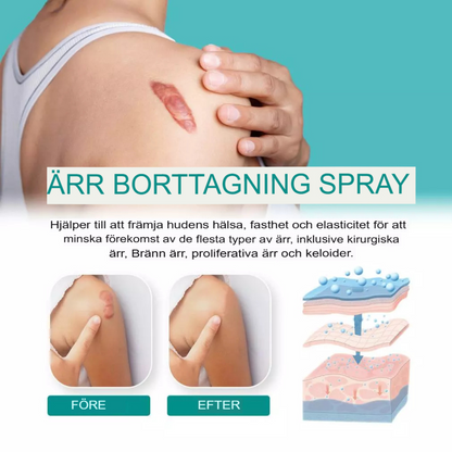 Avancerad Spray för Ärrborttagning | Snabb Läkning & Hudreparation
