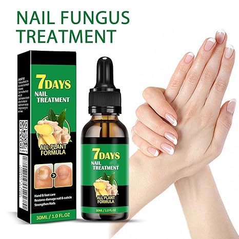 7 Dagars Ingefära Nagelsvampbehandling | Helt Naturligt Antisvamp-Serum för Hand- och Fotvård