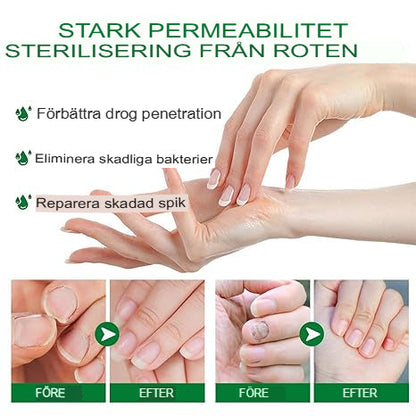 7 Dagars Ingefära Nagelsvampbehandling | Helt Naturligt Antisvamp-Serum för Hand- och Fotvård