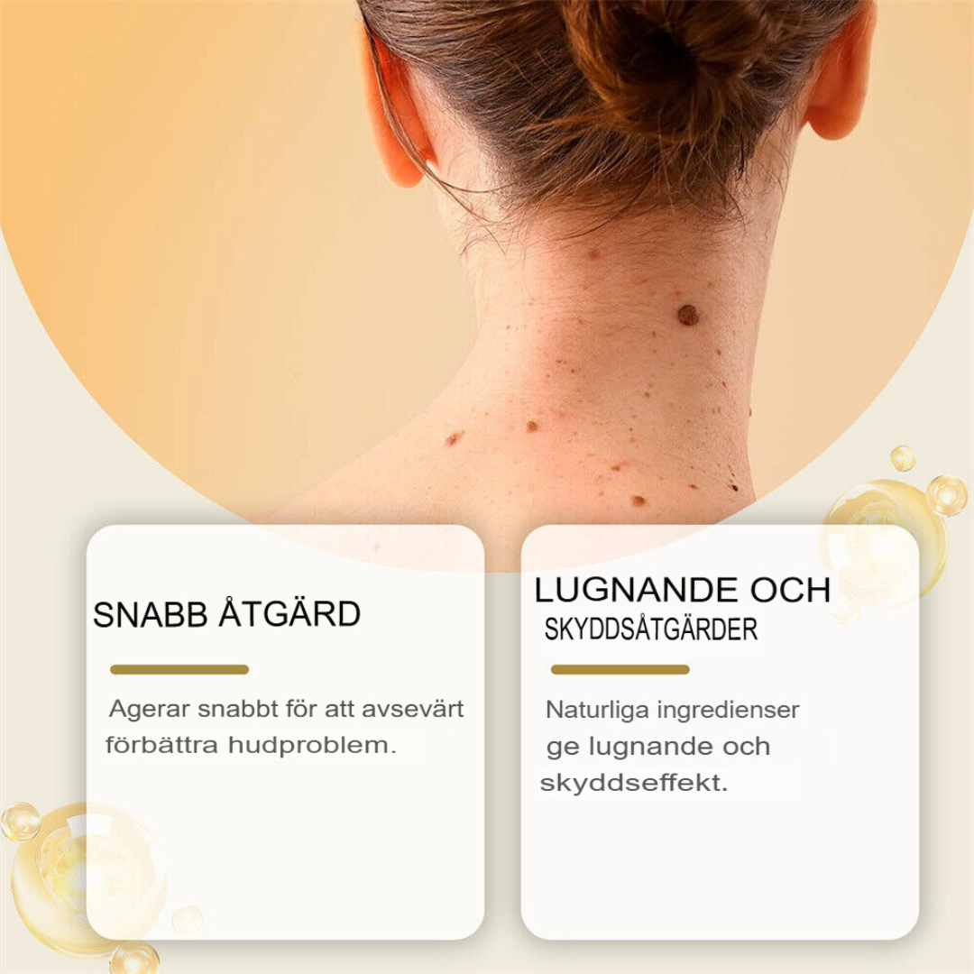 SkinClear | Bivene Behandlingskräm för Vårtor och Molar