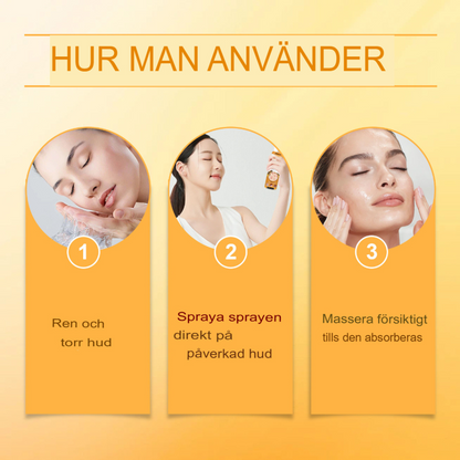 BeeSooth - Psoriasis Lindringsspray | Snabbverkande Biveneformel