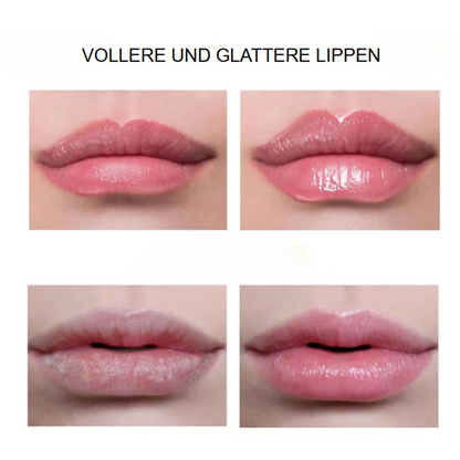 LipFix™ Plump & Shine Serum | Sofortige Lippenvergrößerung