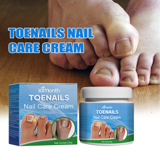 Fungex | Nagelpilz-Creme – Schnelle & Schmerzfreie Hilfe!