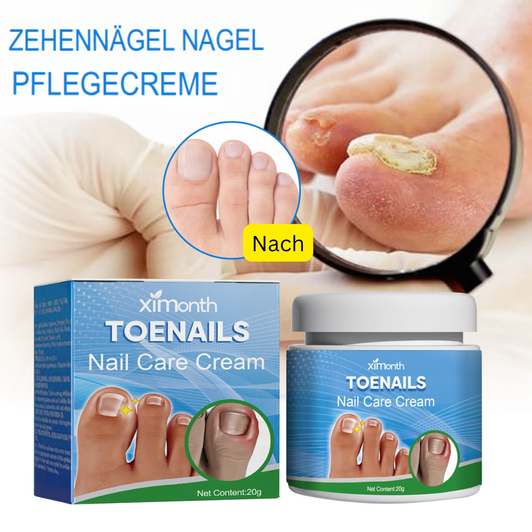 Fungex | Nagelpilz-Creme – Schnelle & Schmerzfreie Hilfe!