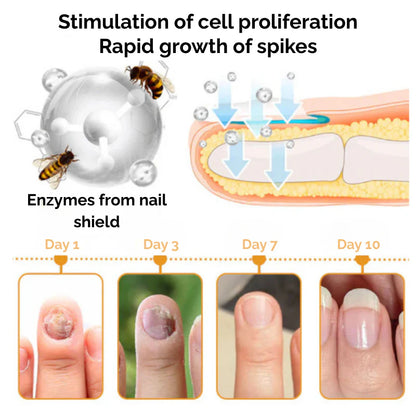 NailCare™ | Beende Nagelschäden für immer