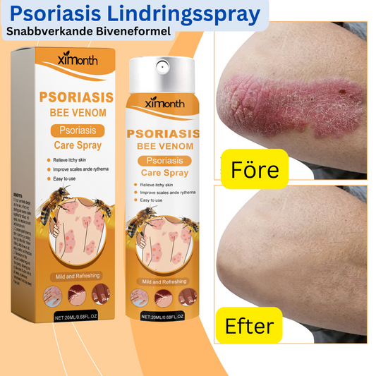 BeeSooth - Psoriasis Lindringsspray | Snabbverkande Biveneformel