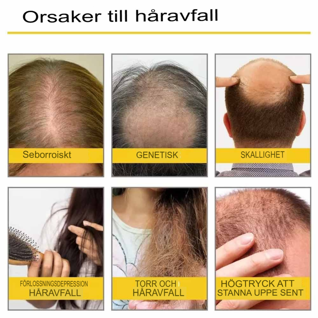 DenseFlow - Essentiell Hårväxtolja | Naturlig Lösning för Tätare Hår
